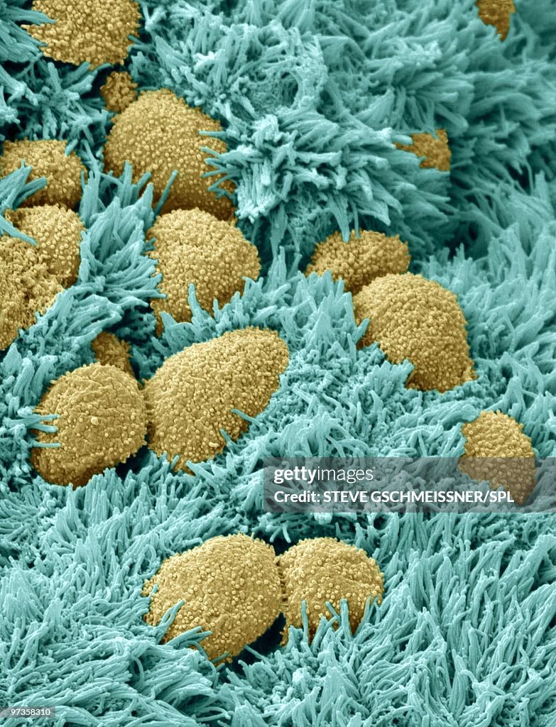 Fallopian tube cells, SEM