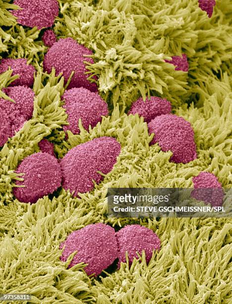 fallopian tube cells, sem - äggledare bildbanksfoton och bilder