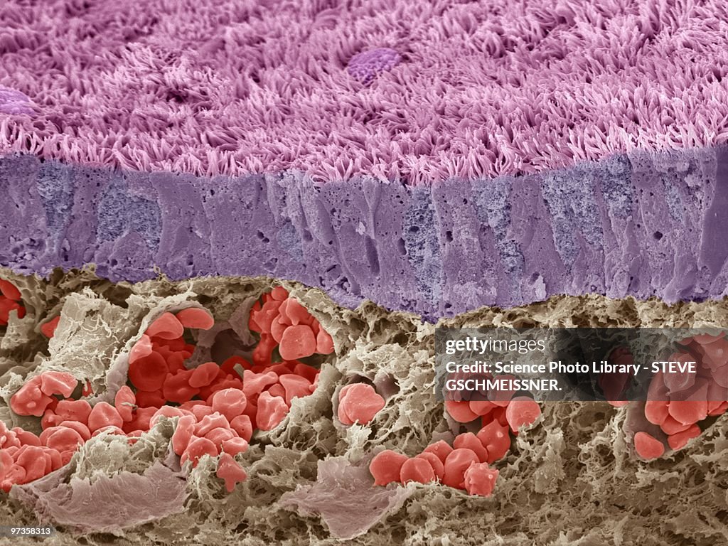 Trachea mucous membrane, SEM