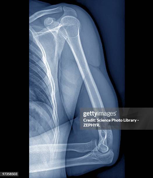 normal shoulder and elbow joints, x-ray - shoulder bone stock pictures, royalty-free photos & images