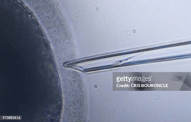 Screen capture shows the moment in which Alpaca sperm is inoculated in-vitro into an ovule as part of the scientific research conducted by Peruvian...