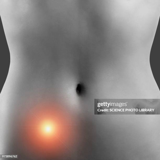 lower abdominal pain, conceptual image - ovarian-cancer stock pictures, royalty-free photos & images
