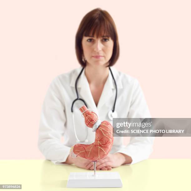 doctor with model of stomach with gastric band - gastric band treatment imagens e fotografias de stock