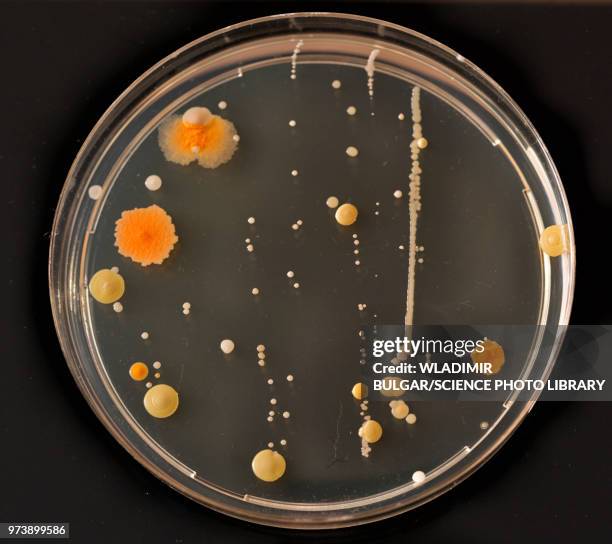 cultures growing on petri dish - yeast laboratory stockfoto's en -beelden