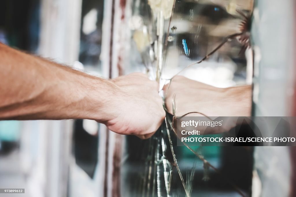 Aggravated man punches a mirror