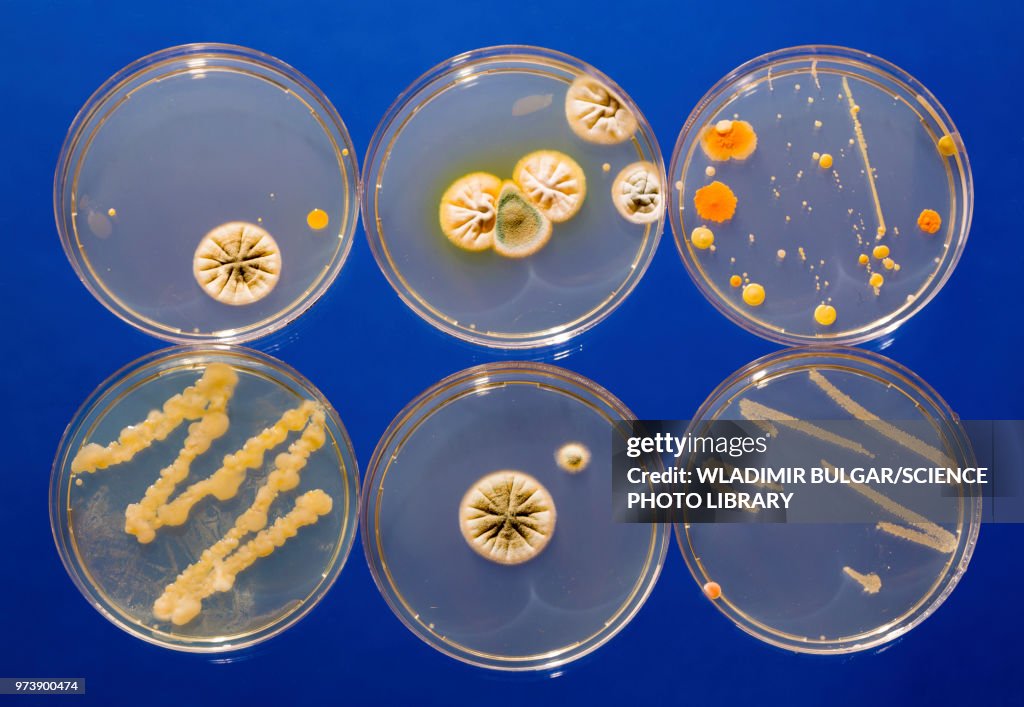 Cultures growing on Petri dishes