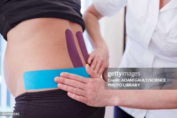 osteopath applying tape - kinesiotape stock pictures, royalty-free photos & images