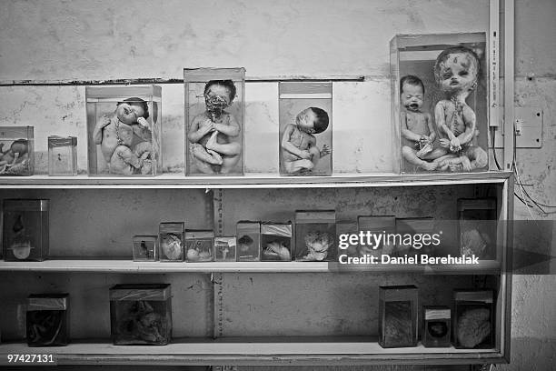 Specimens of aborted and deceased foetuses and infants are displayed as they are seen preserved in embalming fluid at a hospital on November 27, 2009...