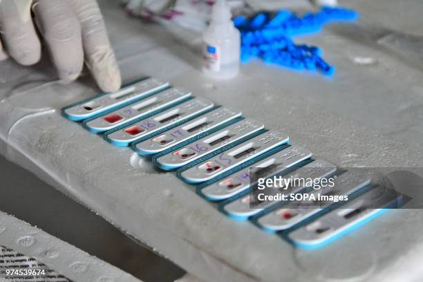 Strips are seen set. A health worker is collecting blood samples from tribal women and preserving them as the samples will go for HIV testing in a...
