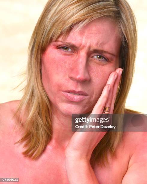 35 year old woman with eczema - blonde hair on tan skin stock pictures, royalty-free photos & images