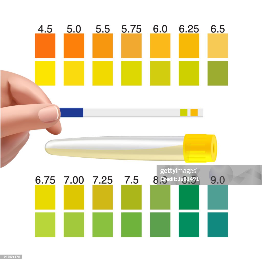 Sample Check Ph Check A Urine Sample Out Of The Tube Urine Ph Test Strip In Doctors ...