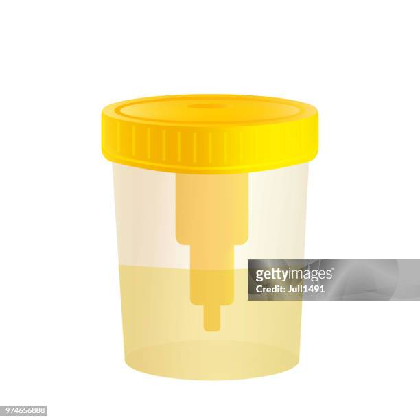 ilustraciones, imágenes clip art, dibujos animados e iconos de stock de muestra realista de la orina en un frasco con una tapa amarilla. cheque médico de pruebas - urine sample
