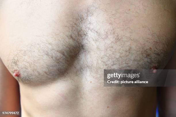 May 2018, Germany, Munich: Black chest hair seen on a man in a sports centre. Photo: Felix Hörhager/dpa