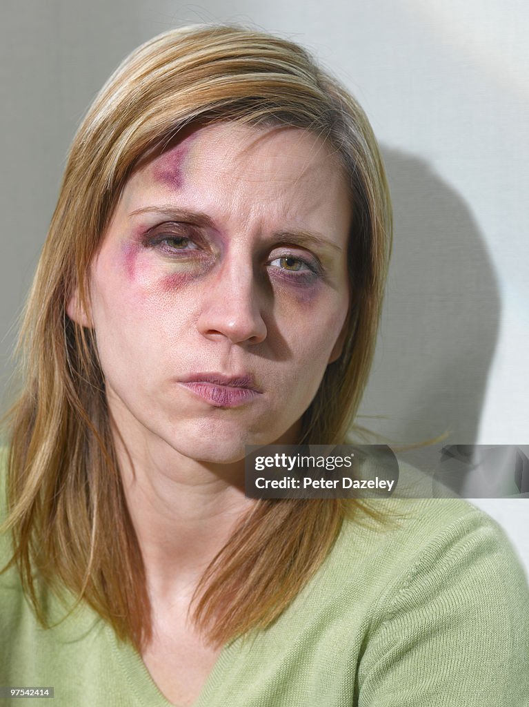 35yr old woman after domestic violence