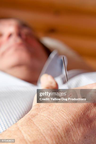 close up of acupuncture needle in man's hand - manchester vermont foto e immagini stock