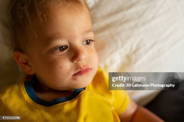 portrait of a male toddler experiencing hand mouth and foot disease - male feet on face foto e immagini stock