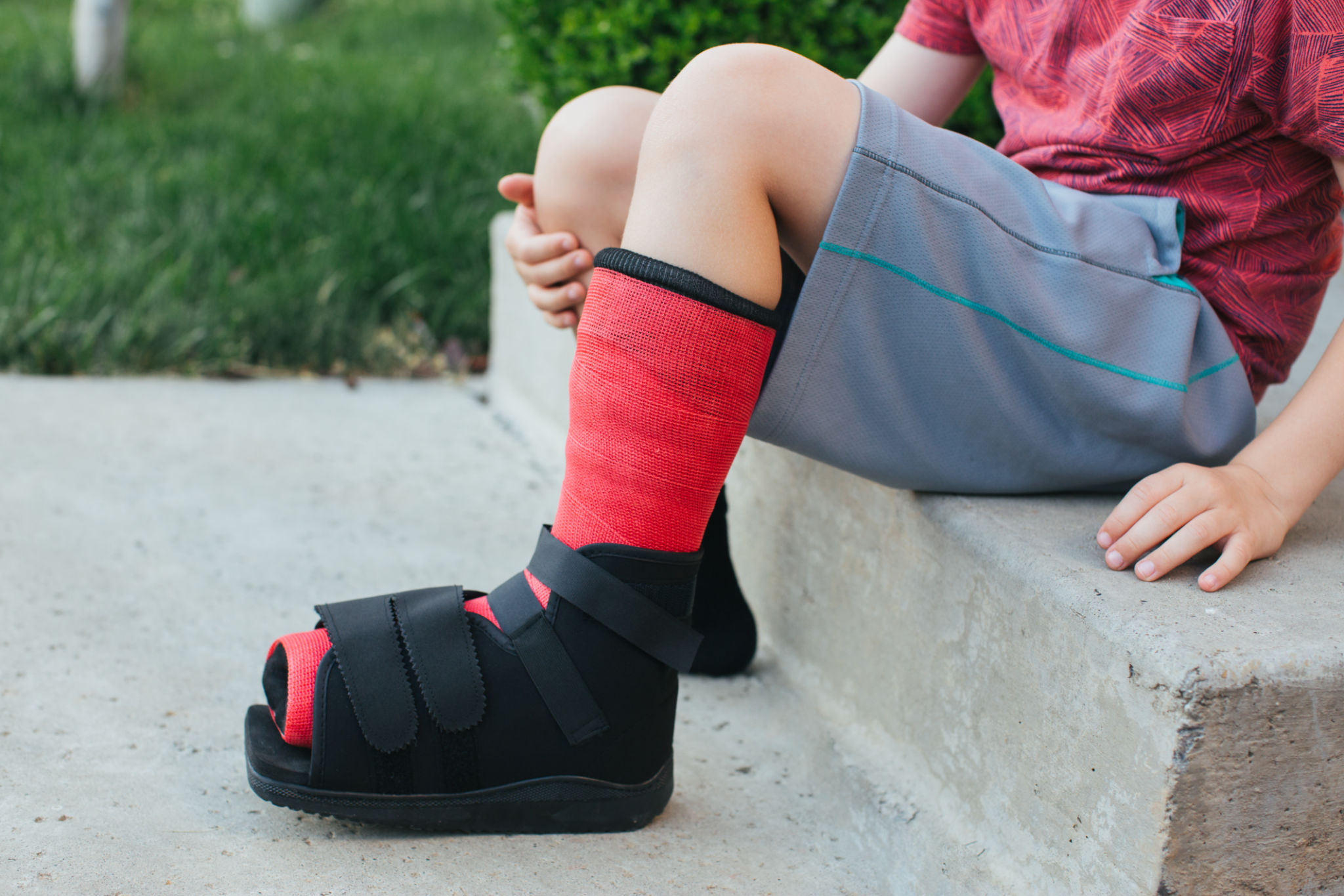 Foot cast on a boy Foot cast on a boy