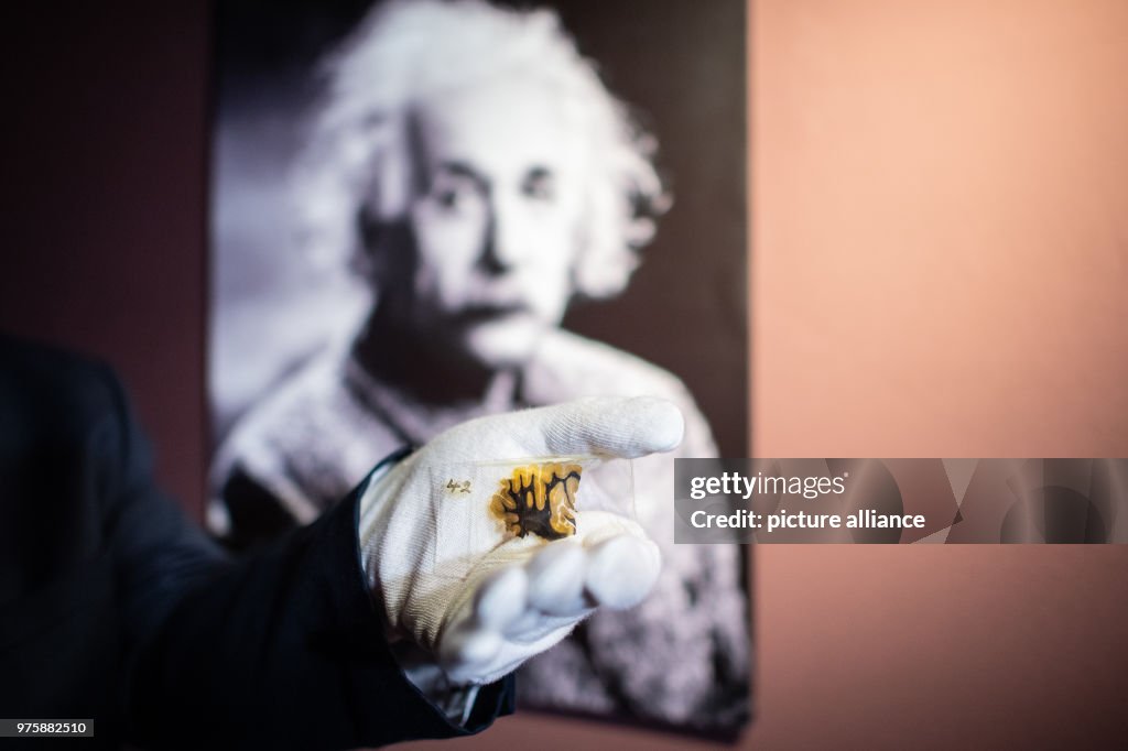 Exhibition shows parts of Albert Einstein's brain