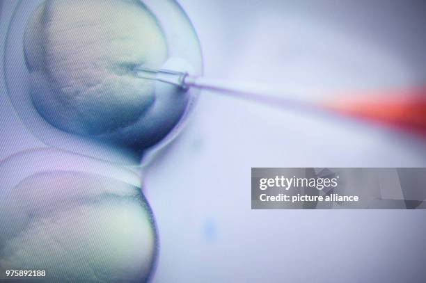 May 2018, Germany, Berlin: A researcher performs a CRISPR/Cas9 process at the Max-Delbrueck-Centre for Molecular Medicine. Photo: Gregor Fischer/dpa