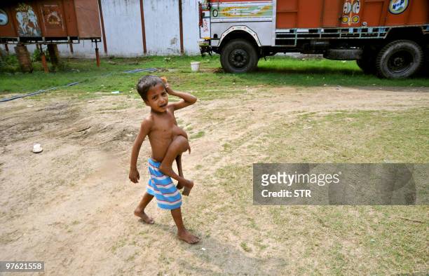 India-disability-children-health, FEATURE by Imran Khan This February 18, 2010 photograph shows Indian boy Deepak Kumar crying as he walks with a...