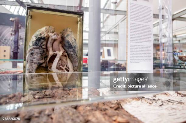 June 2018, Germany, Poessneck: The viscera of the thorax and right lung with stored dirt from the 20th century at the exhibition 'Erlebnis...