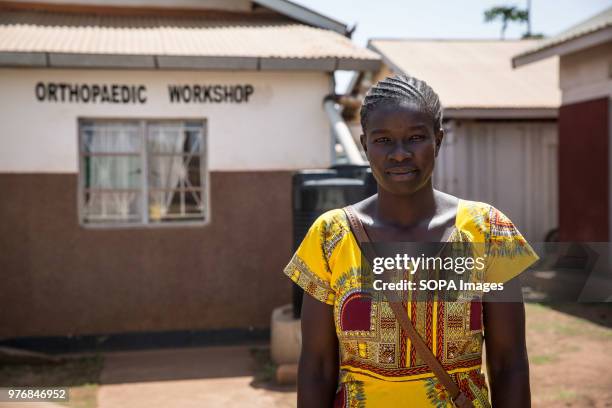 Land mine survivor stands in front of a workshop where medics work. Medics create prosthetics for some of the thousands of Ugandan land mine victims,...