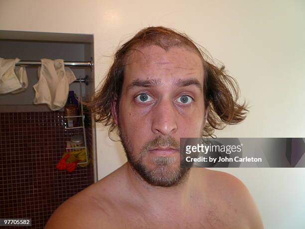man with half-shaved head looks concerned - half shaved hair stockfoto's en -beelden