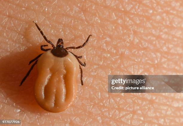 April 2018, Germany, Sieversdorf: A saturated tick crawls up the arm of a boy. Ticks, which normally lurk in the meadows, love temperatures above 7°C...