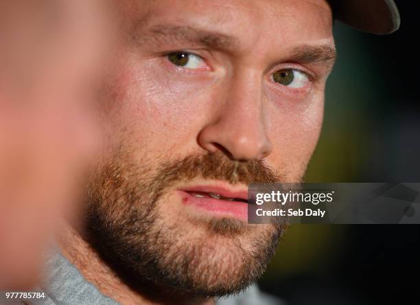 Belfast , United Kingdom - 18 June 2018; Boxer Tyson Fury during a press conference at the National Stadium at Windsor Park in Belfast.