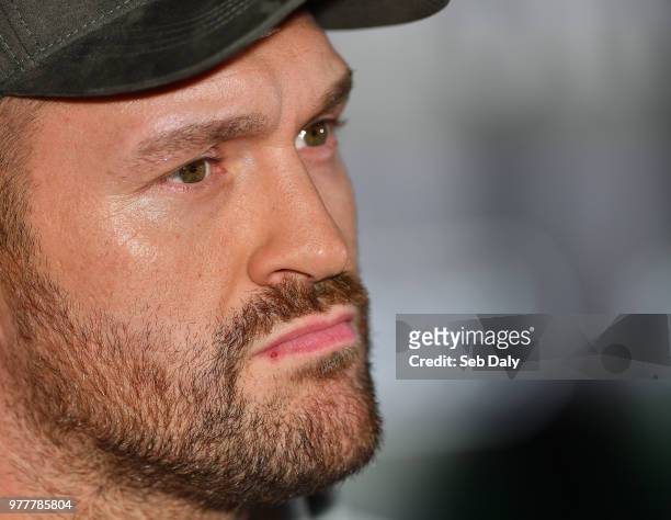 Belfast , United Kingdom - 18 June 2018; Boxer Tyson Fury during a press conference at the National Stadium at Windsor Park in Belfast.