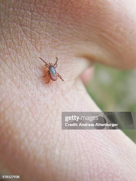 tick on skin - bloodsucking stock pictures, royalty-free photos & images