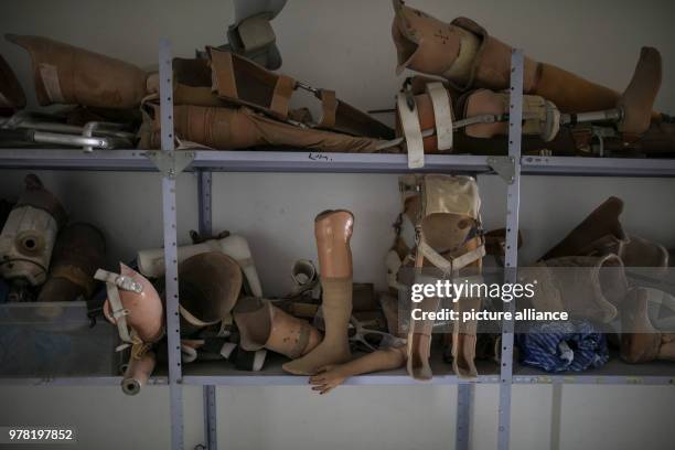 Dpatop - Prosthetic limbs seen at Gaza's Artificial Limbs and Polio Centre carries prosthetic legs, at the centre in Gaza City, 22 April 2018. The...