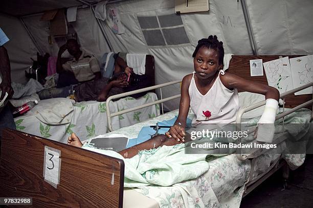 Rosena Favecal, earthquake survivor, at the Red Cross medical observation tent inside General Hospital on February 8th, in Port-au-Prince, Haiti....