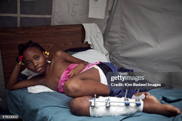 Mariatha Pierre, earthquake survivor, at the Red Cross medical observation tent inside General Hospital on February 8, 2010 in Port-au-Prince, Haiti....
