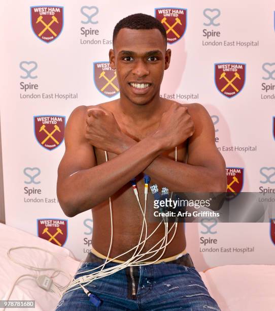 New signing Issa Diop of West Ham United undergoes his medical at Spire London East Hospital on June 19, 2018 in London, England.