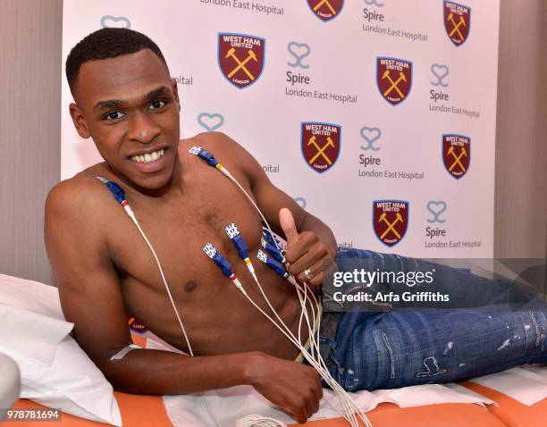 New signing Issa Diop of West Ham United undergoes his medical at Spire London East Hospital on June 19, 2018 in London, England.