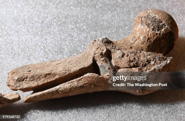 Bullet in a femur, right, was one of the bones from a Civil War era limb pit found on the grounds of the Manassas National Battlefield Park is...