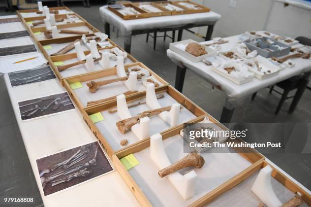 Bones from a Civil War era limb pit found on the grounds of the Manassas National Battlefield Park are displayed at the Smithsonian National Museum...