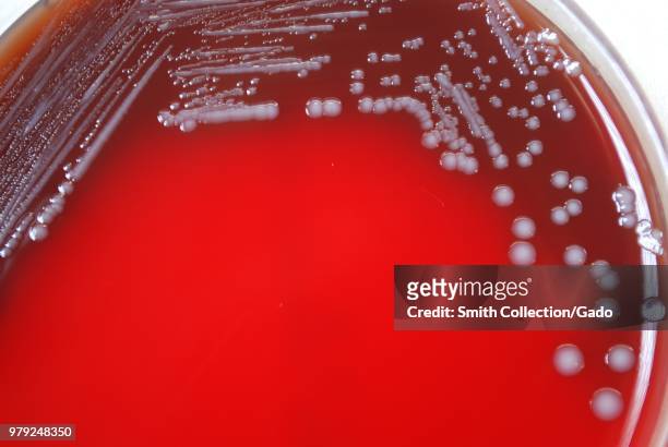 Colonial morphology of Gram-negative Yersinia pestis bacteria grown 72 hours on a medium of sheep's blood agar , 2010. Image courtesy Centers for...