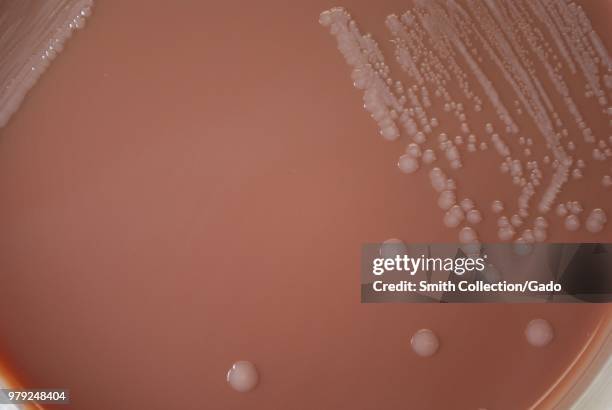 Colonial morphology of Gram-negative Yersinia pestis bacteria grown 72 hours on a medium of chocolate agar, 2010. Image courtesy Centers for Disease...