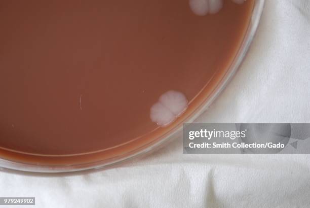 Colonial morphology of Gram-negative Burkholderia mallei bacteria grown 72 hours on a medium of chocolate agar, 2010. Image courtesy Centers for...