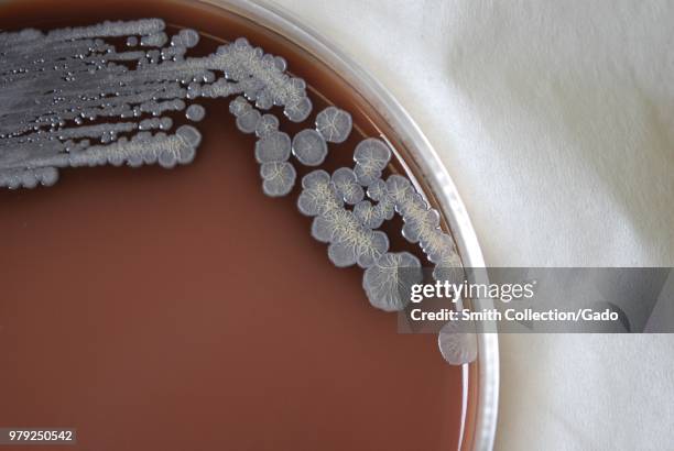 Colonial morphology of Gram-negative Burkholderia pseudomallei bacteria grown 72 hours on a medium of chocolate agar, 2010. Image courtesy Centers...