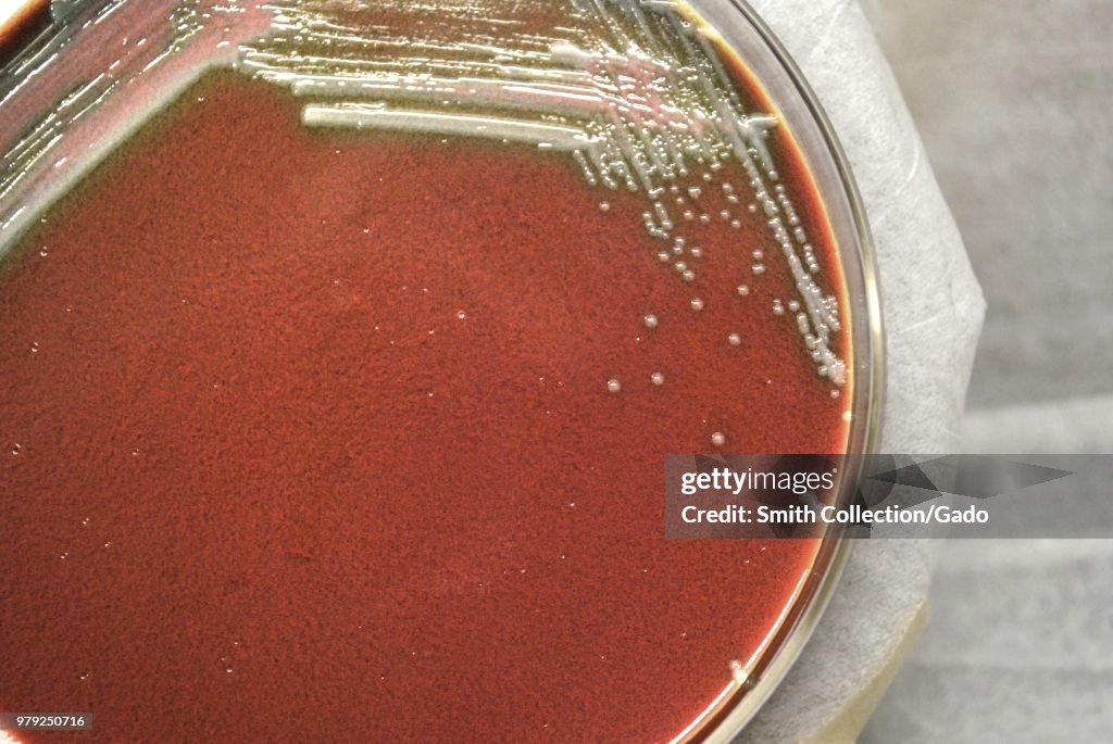 Francisella Tularensis