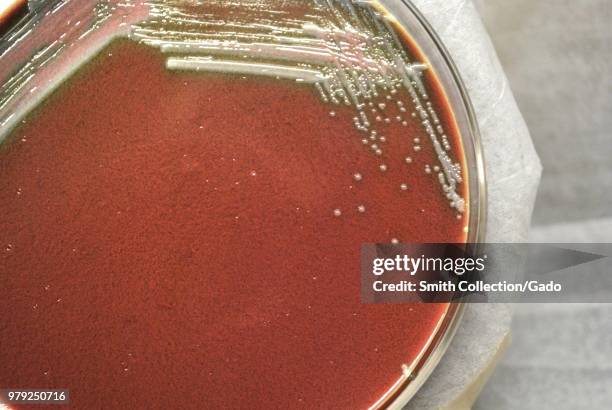 Colonial morphology of Gram-negative Francisella tularensis bacteria grown 48 hours on a medium of cysteine heart agar, 2010. Image courtesy Centers...