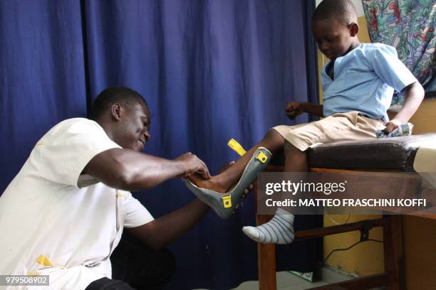 Emmanuel Geraldo is helped by a technician with his new 3D printed prosthetic support on June 19, 2018 at the CNAO in Lome. - Using 3D printing to...