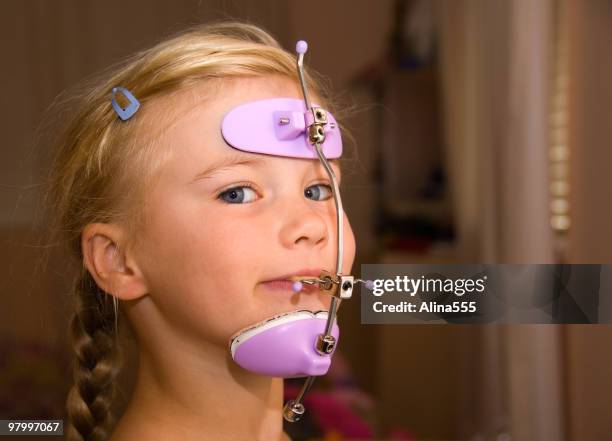 chica con orthodontics cabezal de engranajes - tocado accesorio de cabeza fotografías e imágenes de stock
