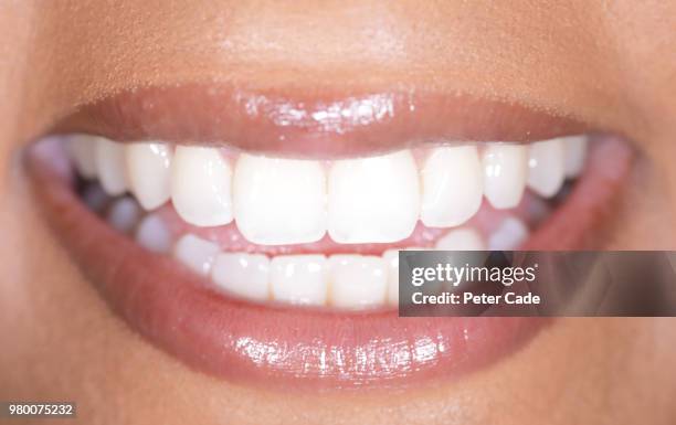 human smile, white teeth - zahnaufhellung stock-fotos und bilder