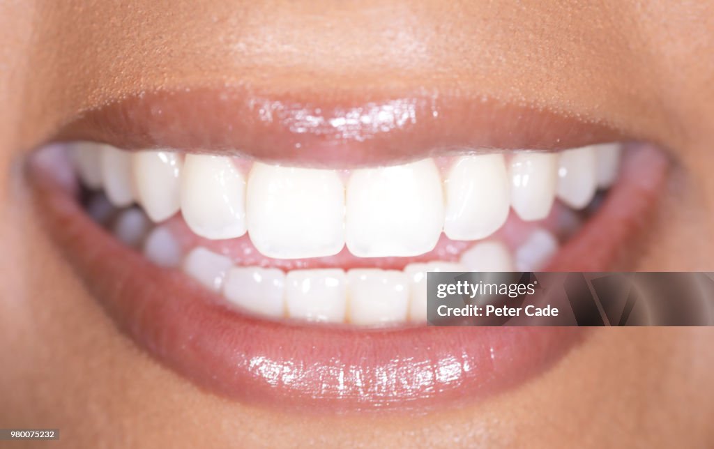 Human smile, white teeth