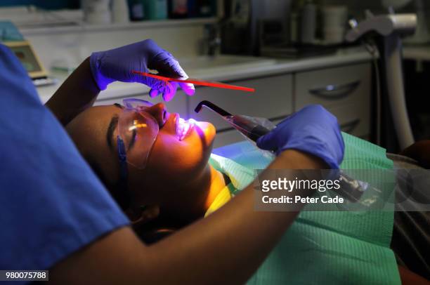 close up of dentistry procedure - halogen light stock pictures, royalty-free photos & images