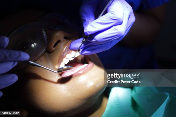 close up of dentistry procedure - dentist stock pictures, royalty-free photos & images